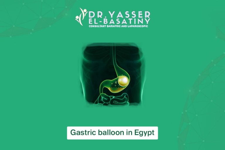 Gastric balloon in Egypt Dr. Yasser AlBasatiny Senior Consultant